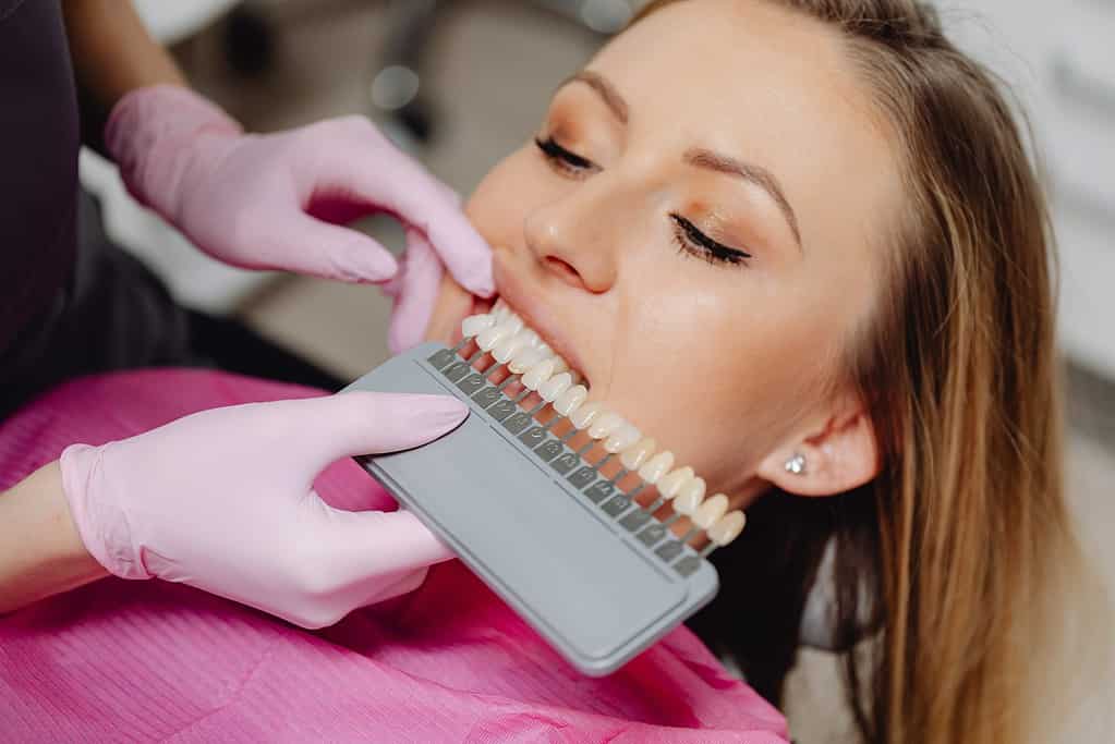 woman getting veneers